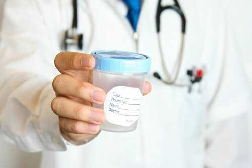 Xét nghiệm tinh dịch đồ 
